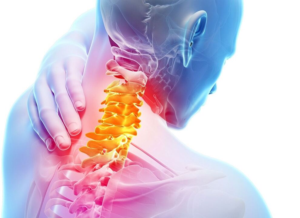 osteochondrosis of the cervical vertebrae